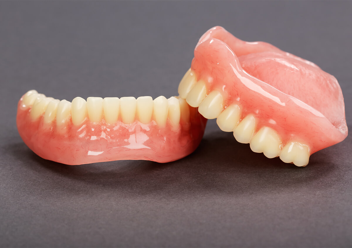 Are Dentures Cheaper Than Implants in Los Banos CA Area